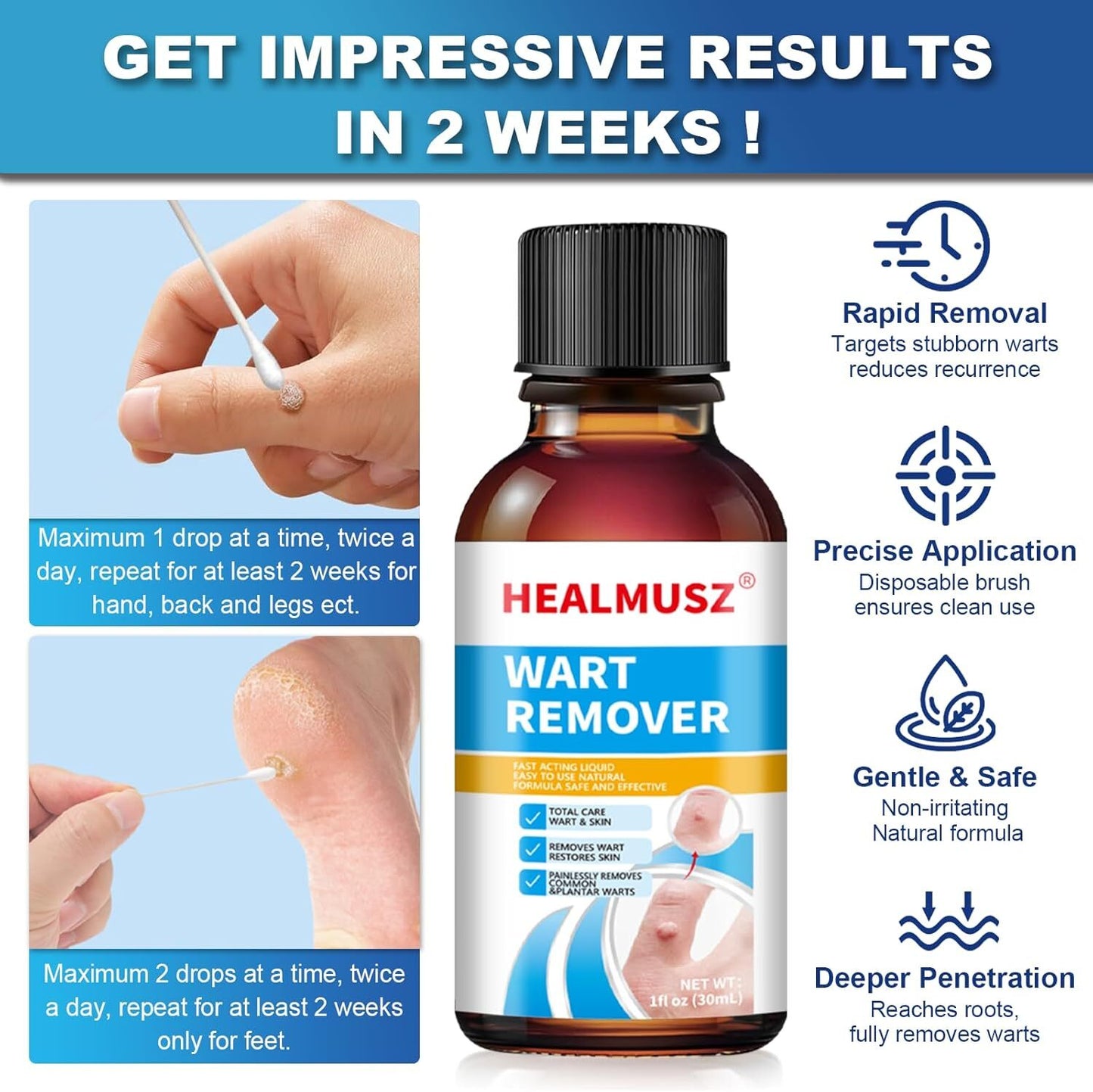 Fast-Acting Wart Remover with Salicylic Acid, Wart Removal Cream for Women Men,