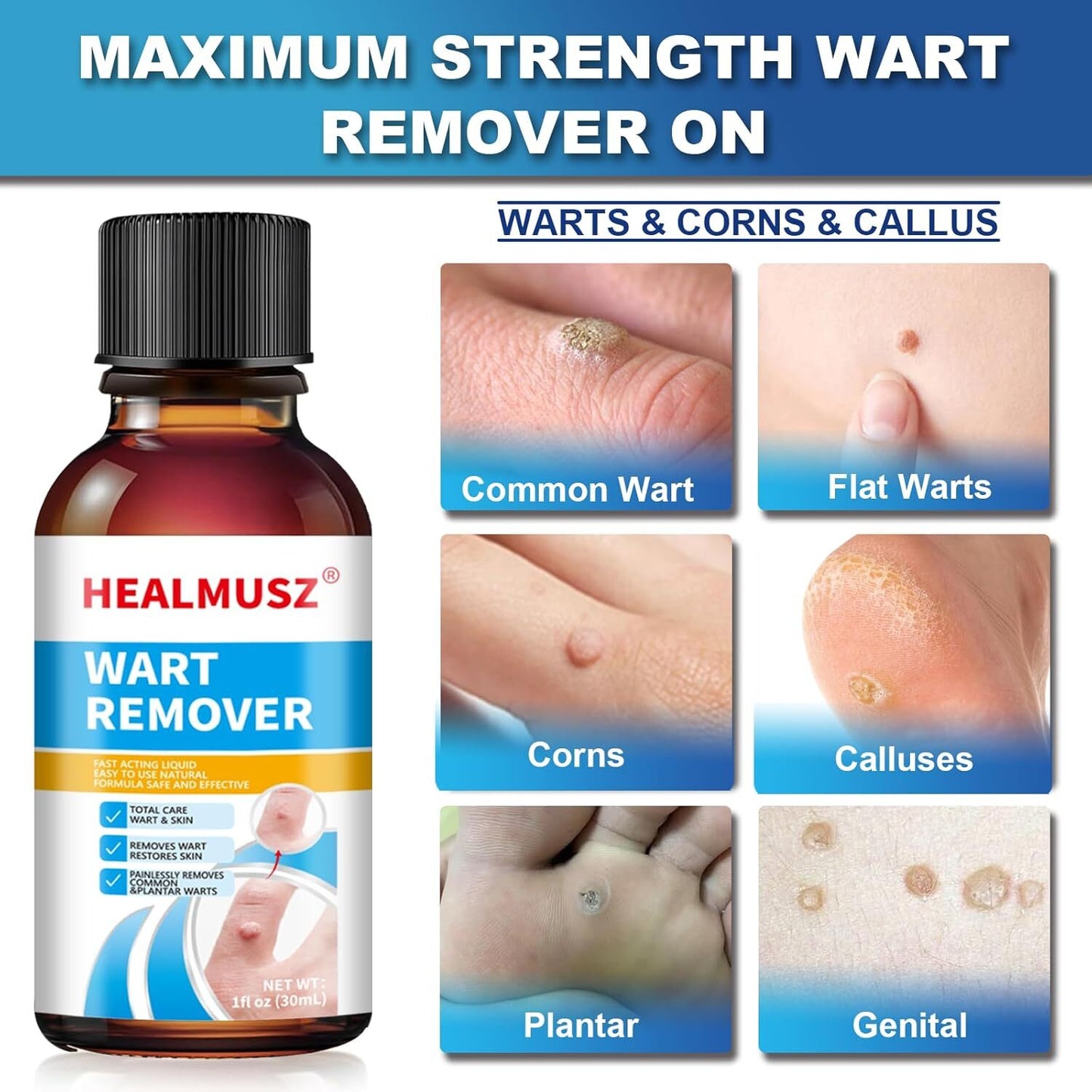 Fast-Acting Wart Remover with Salicylic Acid, Wart Removal Cream for Women Men,