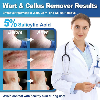 Fast-Acting Wart Remover with Salicylic Acid, Wart Removal Cream for Women Men,