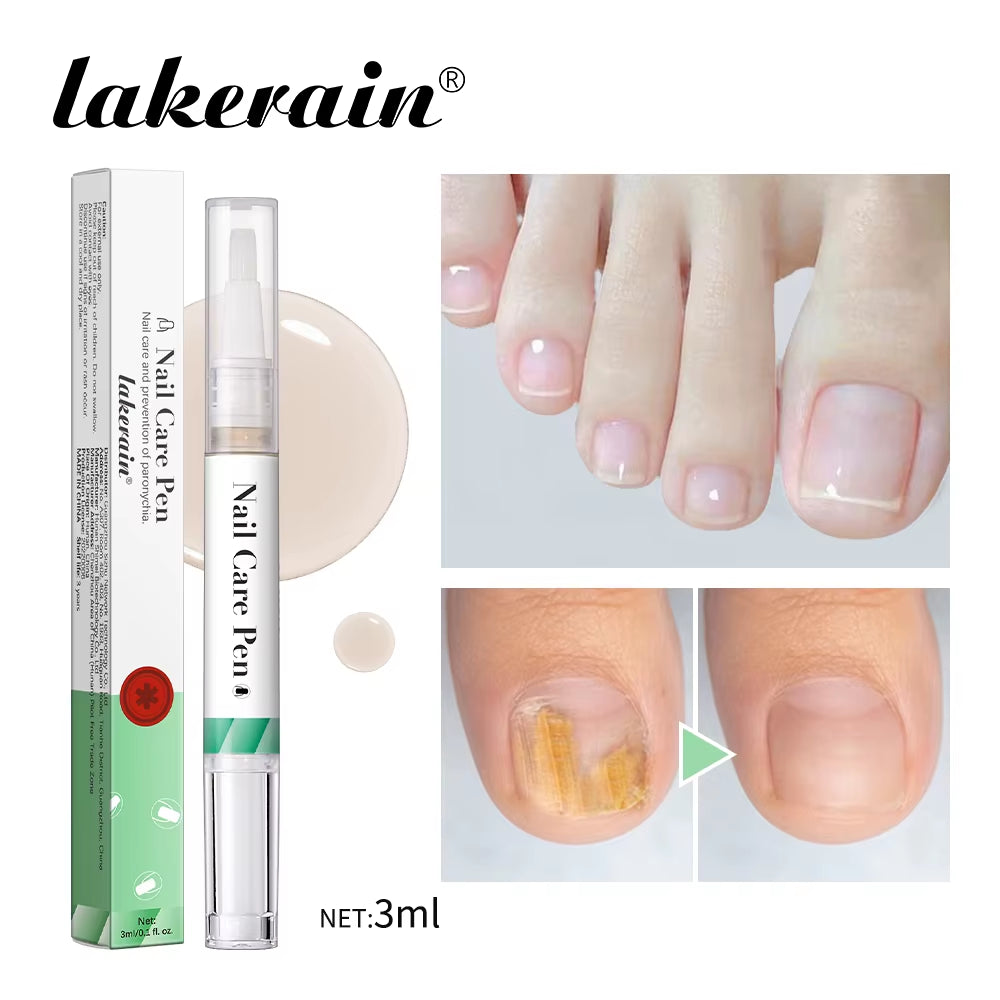 Brittle Nail Restoration Pen 4Ml Antioxidant & Natural Oil Blend Strengthens Moisturizes & Repairs Dry Nails Completely