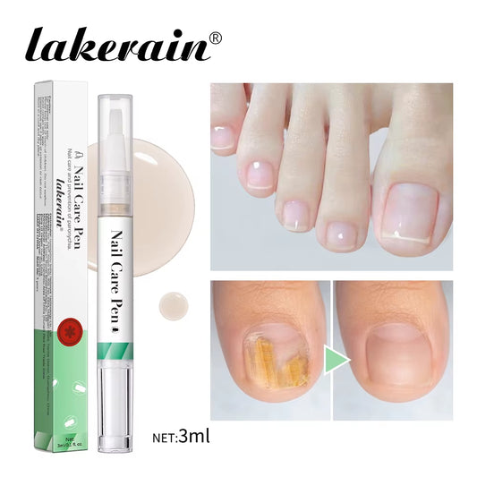 Brittle Nail Restoration Pen 4Ml Antioxidant & Natural Oil Blend Strengthens Moisturizes & Repairs Dry Nails Completely