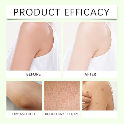Neuropathy Cream, Magnesium Body Butter, Magnesium Cream, Deeply Moisturizes Skin, Keep Soft Smooth Lotion, Suitable for All Skin Types (2PC, 1)