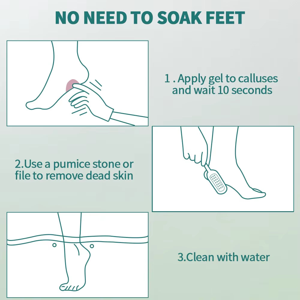 Nailpop Professional Callus Remover for Feet Extra Strength Gel & Rasp Foot File Kit Dead Skin Remover Cracked Heels Dry Skin