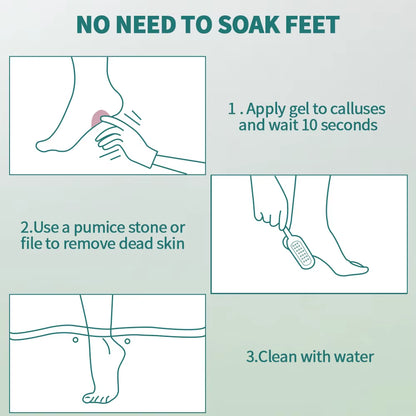 Nailpop Professional Callus Remover for Feet Extra Strength Gel & Rasp Foot File Kit Dead Skin Remover Cracked Heels Dry Skin